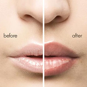 Lips Plumper